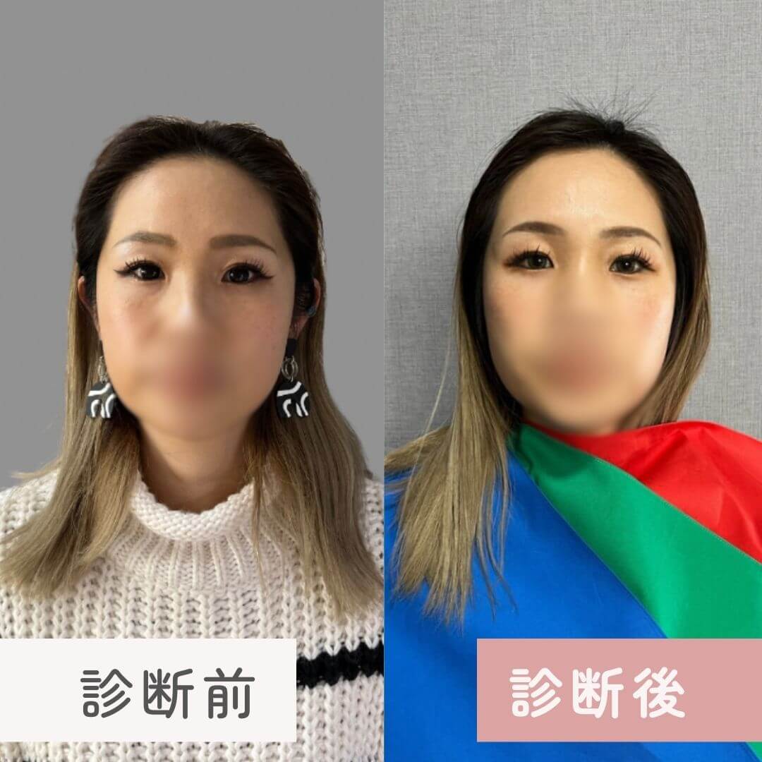 トータル診断のビフォーアフター